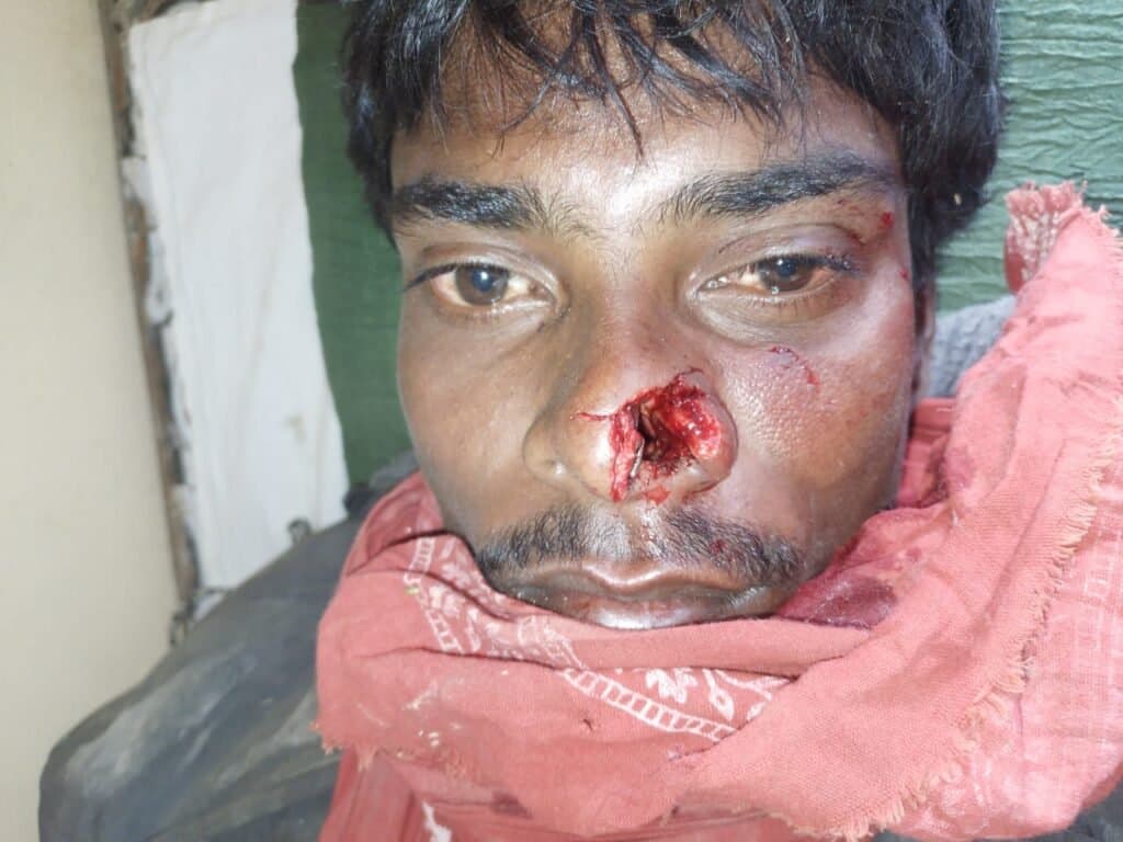 बन्दर ने युवक की नाक काटी, हमले से आधा दर्जन घायल, ग्रामीण दहशत में