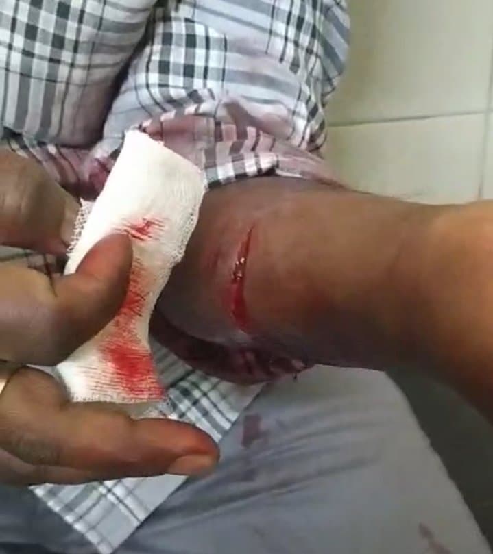 कुल्हाड़ी से हमला कर किया घायल