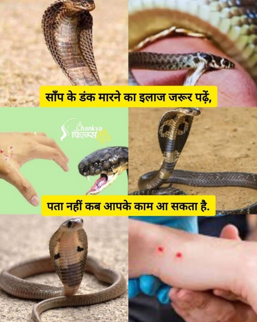 सर्प दंश से बचाव की एक महत्वपूर्ण जानकारी