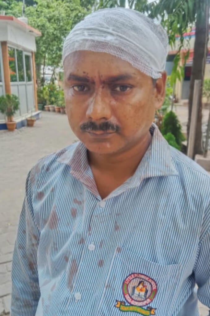 पेड़ की डाल काटने को लेकर दंपत्ति ने ईट से मारकर सिर फोड़ा