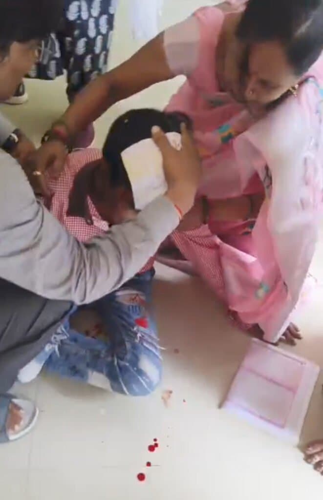 बालापार कंपोजिट विद्यालय की छत का प्लास्टर गिरने से बच्चा हुआ गंभीर रूप से चोटिल