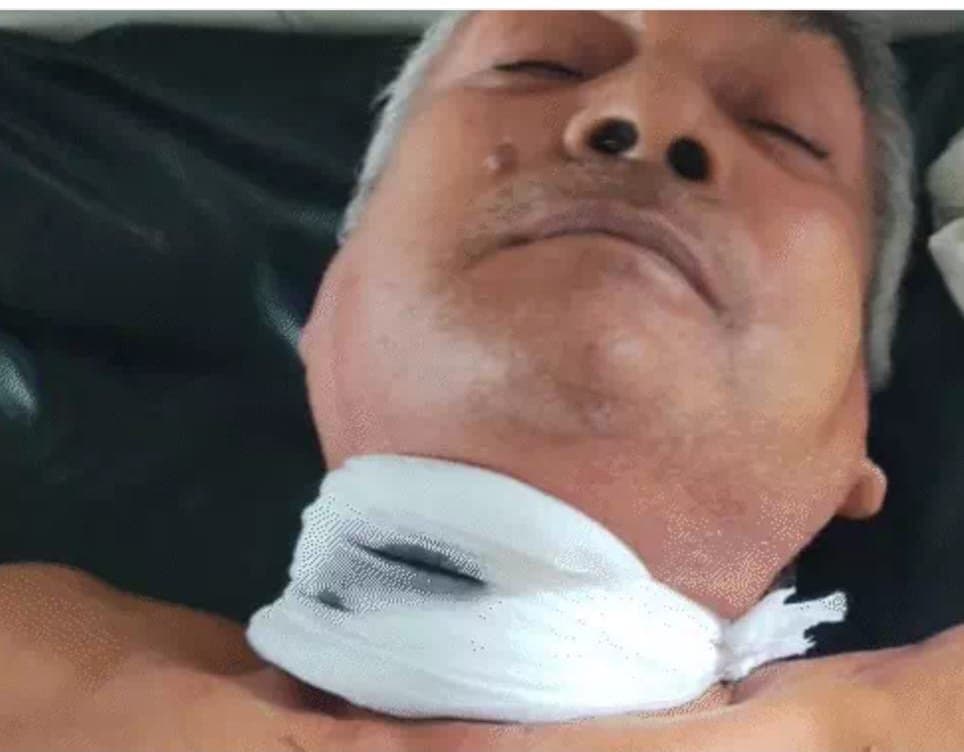 युवक ने दुकानदार को मारा चाकू