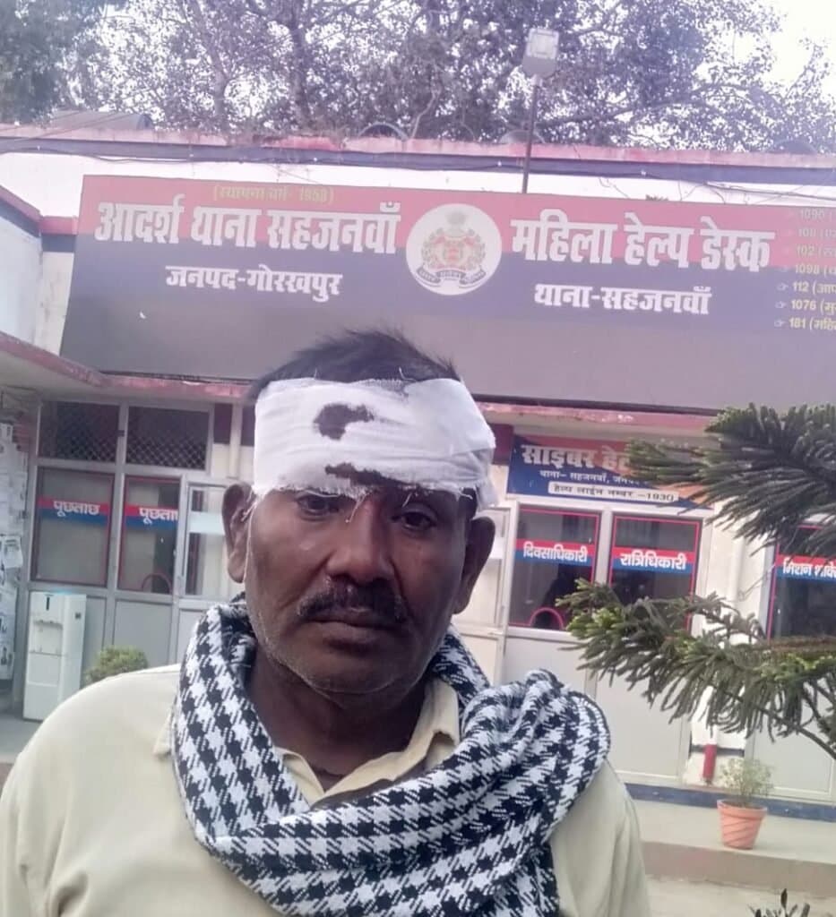 रास्ते के विवाद को लेकर मनबढ़ ने सबल से किया हमला, हालत गंभीर