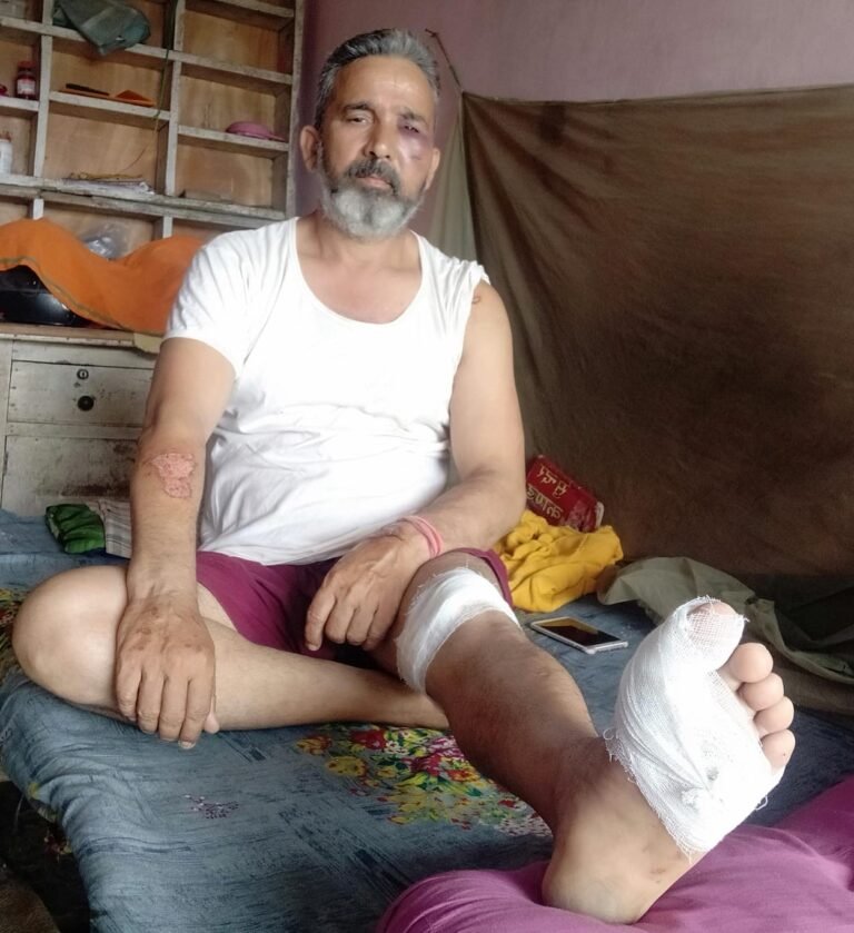 मोटरसाइकिल की ठोकर से पत्रकार बृजेश पाठक गंभीर रूप से घायल