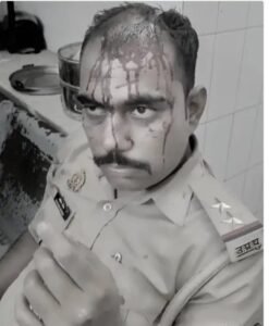 पुलिस टीम पर जानलेवा हमला, दरोगा और सिपाही गंभीर रूप से घायल