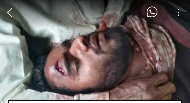 आशिक और पत्नी ने मिलकर पति का रेता गला हालत नाजुक,अस्पताल हुआ रेफर