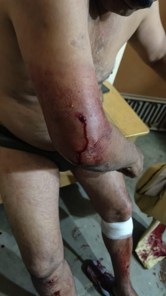 गुरुद्वारे में प्रसाद लेने पहुंचे बीएसएफ जवान पर कृपाण से हमला, हत्या के प्रयास में केस दर्ज